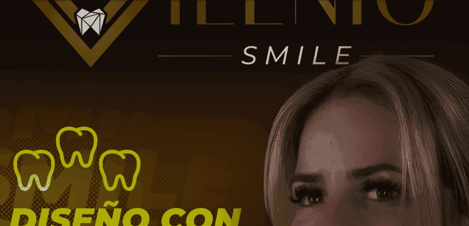 Milenio Smile — detalle 4